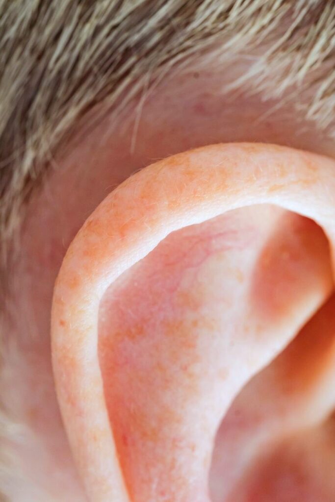 هل خلط الحروف في النطق طبيعي في هذا العمر؟